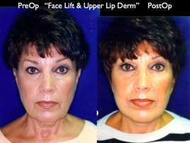 Cosmetic Patients.036.jpg