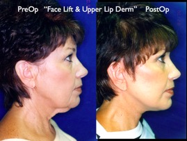 Cosmetic Patients.037.jpg