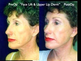Cosmetic Patients.038.jpg