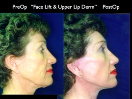 Cosmetic Patients.039.jpg