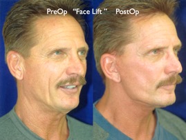 Cosmetic Patients.040.jpg