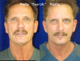 Cosmetic Patients.041.jpg