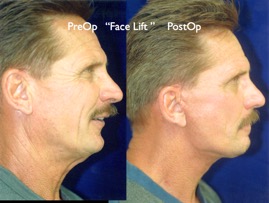 Cosmetic Patients.042.jpg