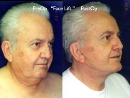 Cosmetic Patients.043.jpg