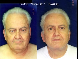 Cosmetic Patients.044.jpg