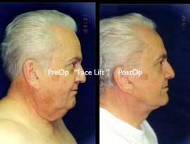 Cosmetic Patients.045.jpg