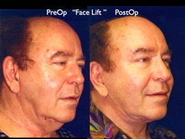 Cosmetic Patients.046.jpg