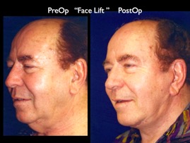 Cosmetic Patients.047.jpg