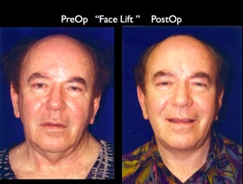Cosmetic Patients.048.jpg