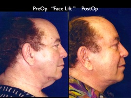 Cosmetic Patients.049.jpg