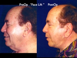 Cosmetic Patients.050.jpg
