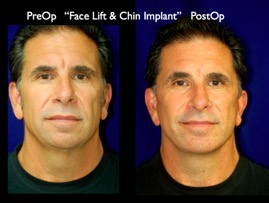 FacLift.014.jpg