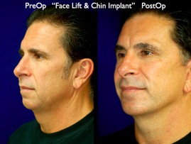 FacLift.015.jpg