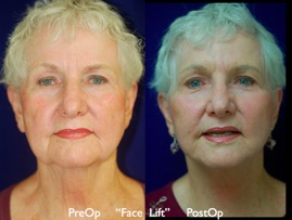 FacLift.020.jpg