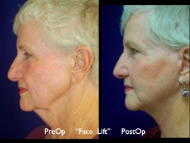 FacLift.022.jpg