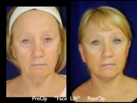 FacLift.026.jpg