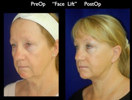 FacLift.027.jpg