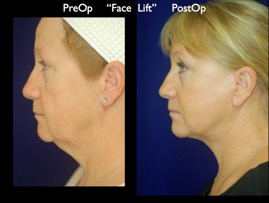 FacLift.028.jpg