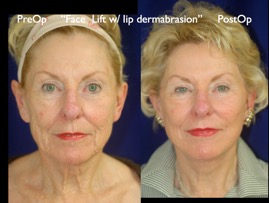 FacLift.029.jpg