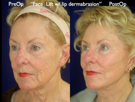 FacLift.030.jpg