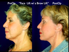 FacLift.034.jpg