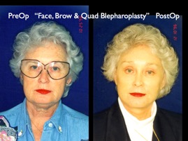 Cosmetic Patients.011.jpg