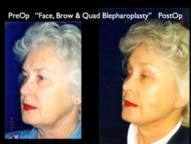 Cosmetic Patients.012.jpg