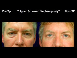 4S-PLCU-Face.005.jpg