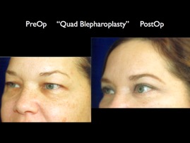 Cosmetic Patients.099.jpg