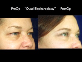 Cosmetic Patients.100.jpg