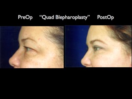 Cosmetic Patients.102.jpg