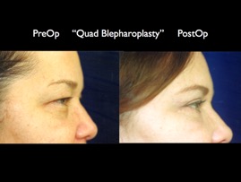 Cosmetic Patients.103.jpg