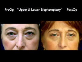 4S-PLCU-Face.015.jpg