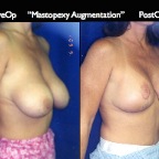 Cosmetic Patients.080